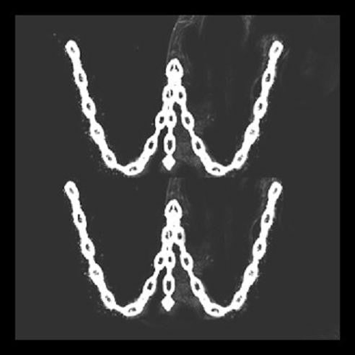 Women In The Woods - Stanza Nera (LP Ltd) - USED
